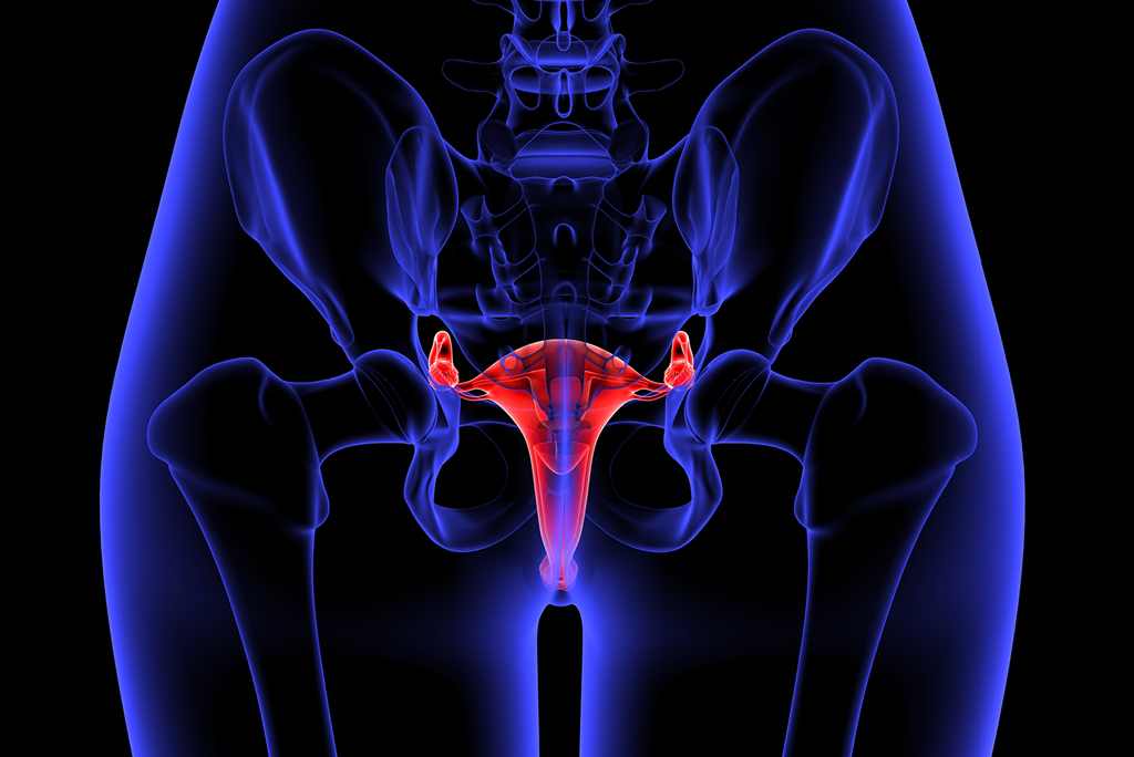 Qué es el Hidrosalpinx y cómo puede afectar tu fertilidad – Clínica CER