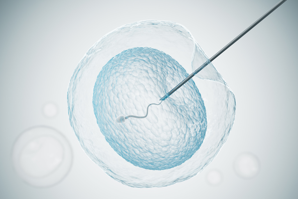 ¿Cuándo se recomienda la ICSI? – Clínica CER
